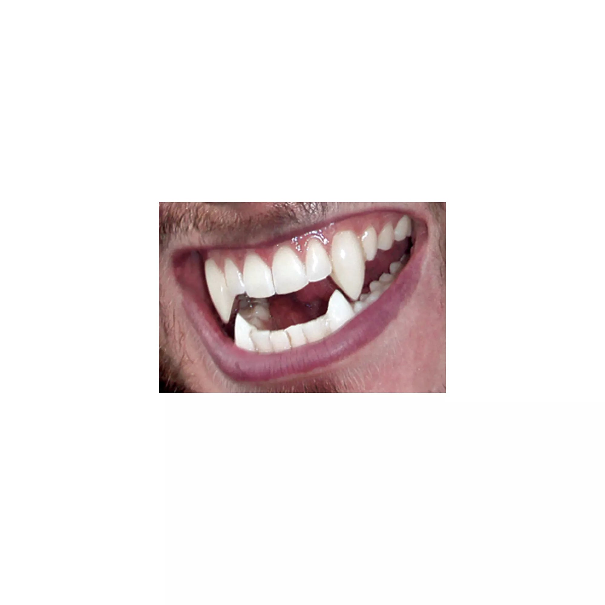 Werewolf Fangs